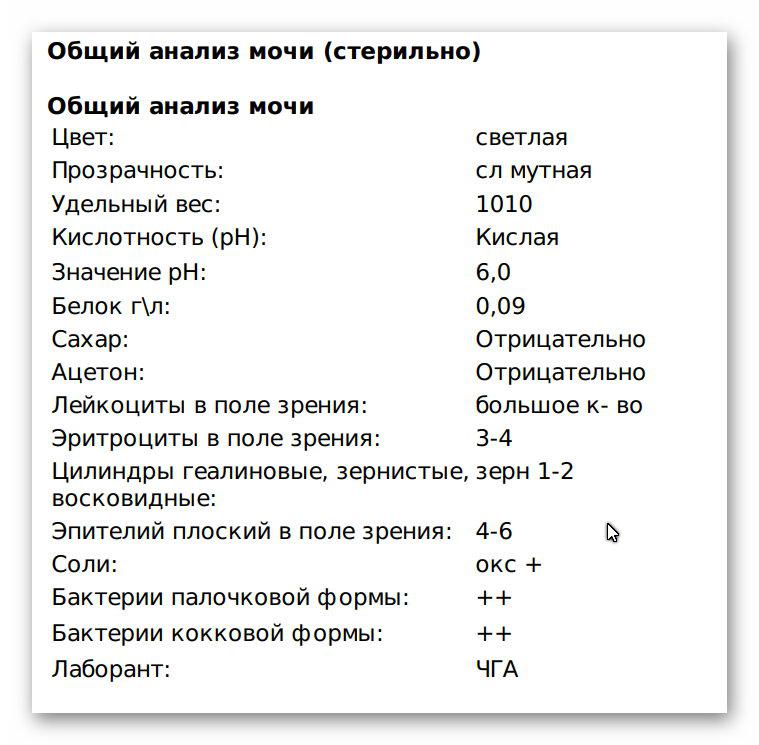 Моча на стерильность как собрать