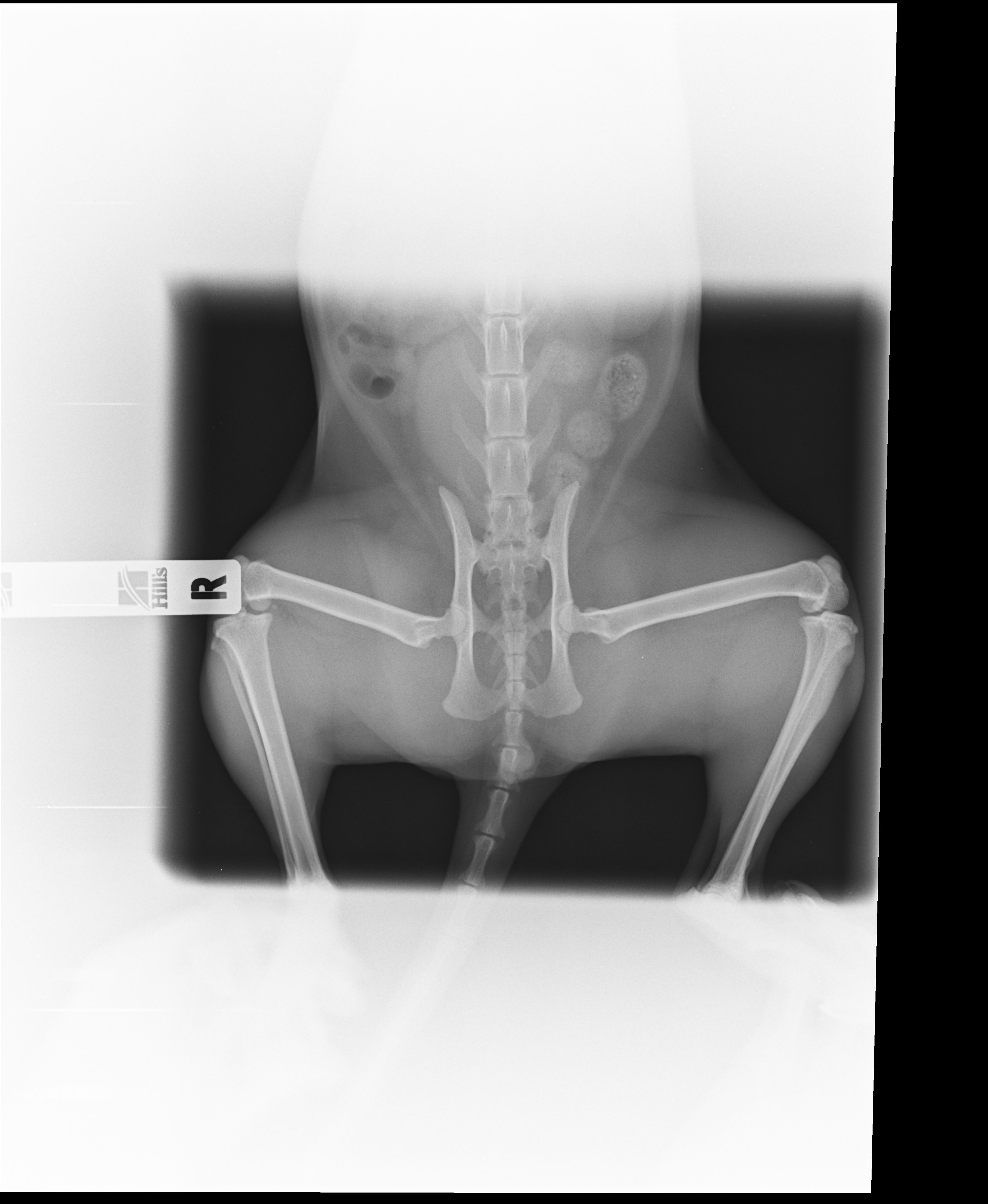 Рентгеновские снимки таза девушек